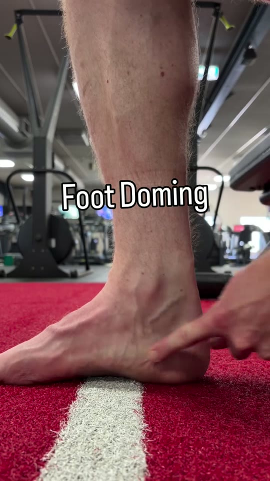 Foot doming: screenshot from the supplied demonstration at 0:31